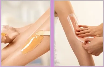 Hair Removal Services services