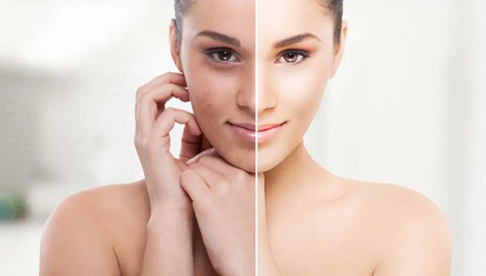 Skin Brightening services